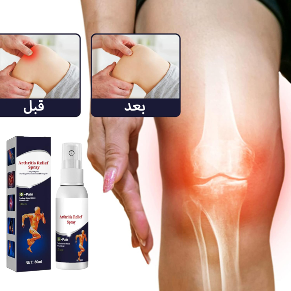 ⁦• عرض 3 قطعة  بخاخ المفاصل السحري⁩ - الصورة ⁦3⁩